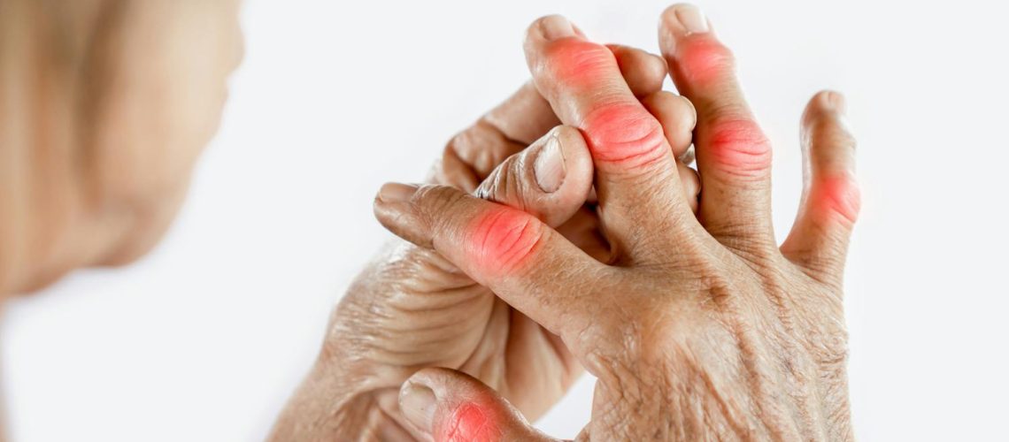 Arthrite du doigt : causes , symptômes, traitements